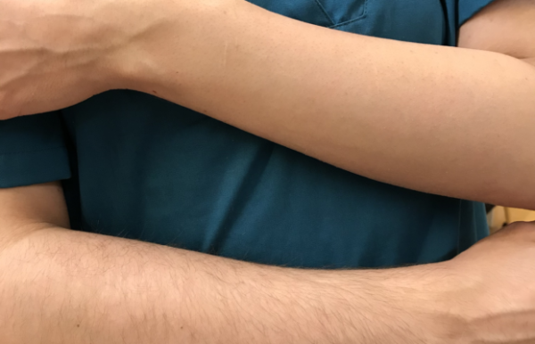 EPILATION BRAS